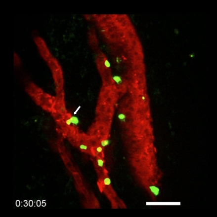 Immunothérapie